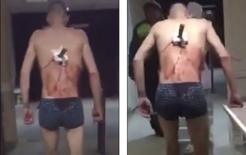 Руска му работа: Мъж с нож в гърба излезе от болницата, за да пуши ВИДЕО