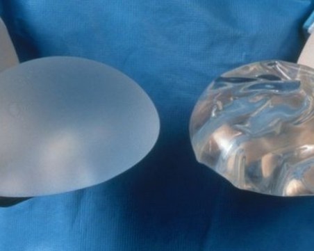 Жена почина от рак заради импланти в задните части