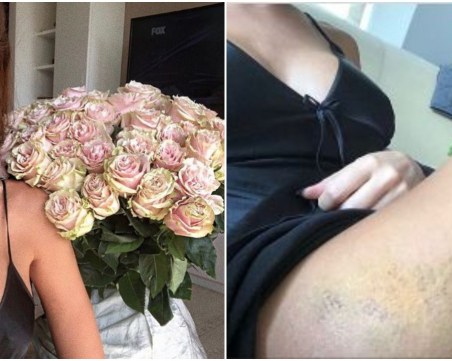 Моника Валериева оперира задните си части! Похвали се с бразилски форми СНИМКИ