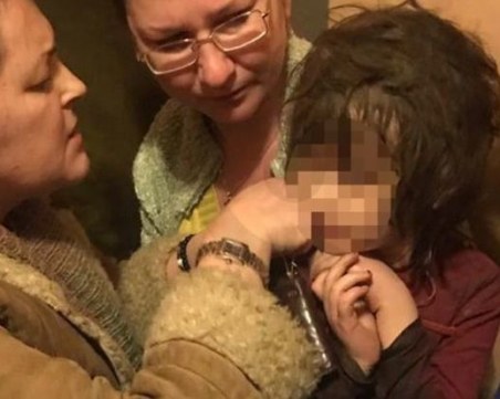 Спасиха 5-годишно дете, огърлица враснала в шията му ВИДЕО