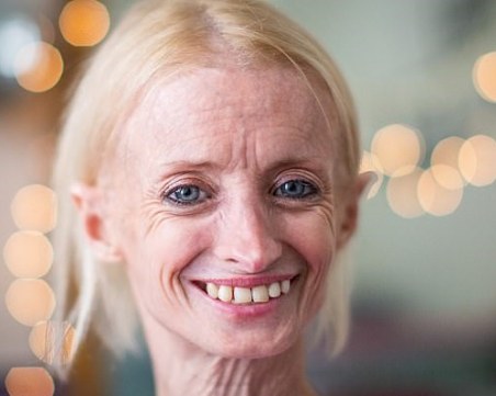 Една на 50 милиона! Това е най-старата 41-годишна жена СНИМКИ