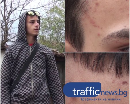 Вижте разказа на пребитото от полицаи 19-годишно момче от Карлово ВИДЕО