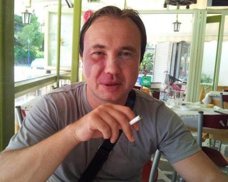 Общински шеф от Червен бряг блъсна друга кола и избяга