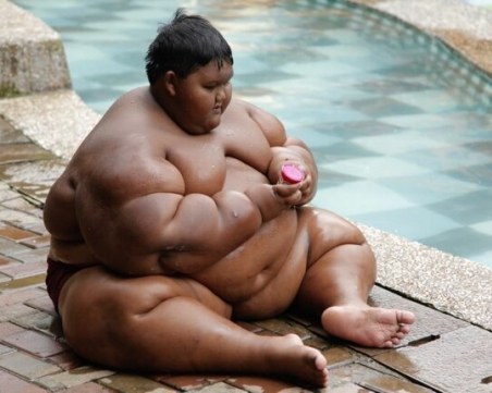 Най-дебелото момче на света отслабна с над 100 кг