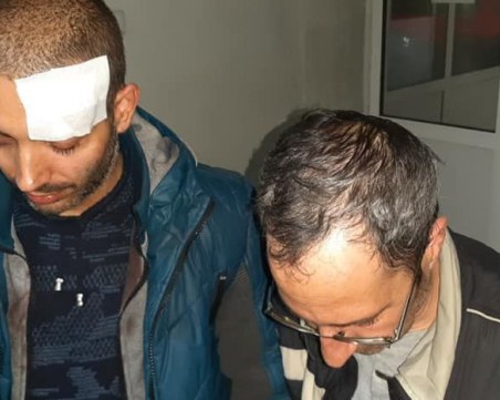 Операторът с разбита глава от Габрово: Палка на жандармерист, а не камък на протестиращ ме удари