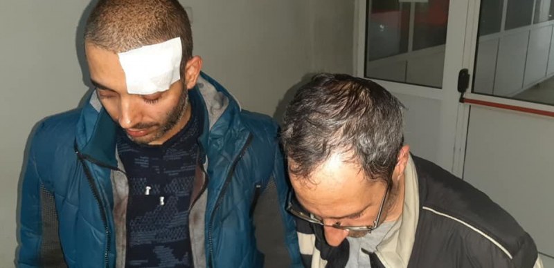 Операторът с разбита глава от Габрово: Палка на жандармерист, а не камък на протестиращ ме удари