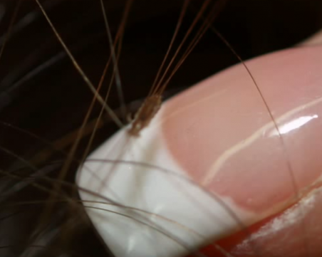 Въшки налазват училищата в Пловдив! Родители: С месеци не можем да изчистим децата си