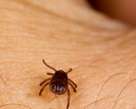 Мъж от пловдивско село с марсилска треска! Ухапал го кърлеж