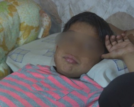 Семейството на детето със забита ножица в главата чакало линейка час и половина