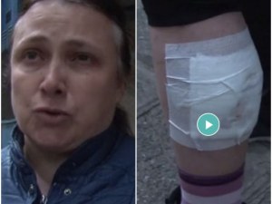 Жената, нападната от питбул, е с разкъсан крак! Собственикът: Пуснах го да посрещне майка ми