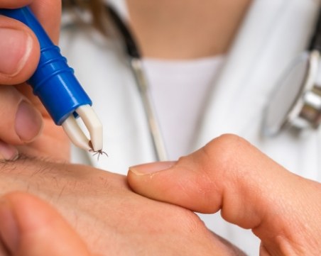 Какво да правим при ухапване от кърлеж?