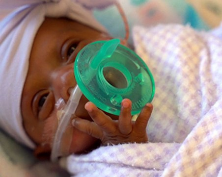 Роди се най-малкото бебе в света! Сейби е само 245 грама