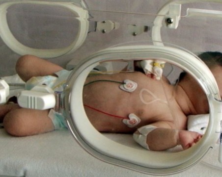 Лекари спасиха родилка, изпаднала в кома след рядко усложнение