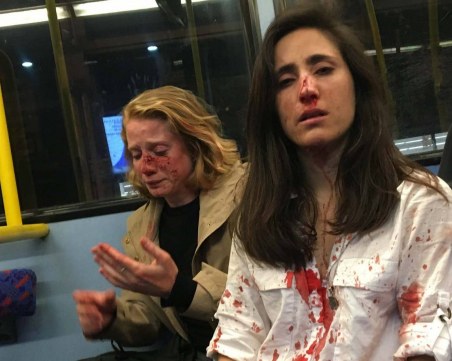 След отказ от целувка… брутален побой над лесбийки в Лондон