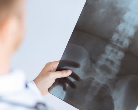 Старчески болки при млади хора предупреждават за ревматични заболявания! Прегледайте се безплатно в Пловдив