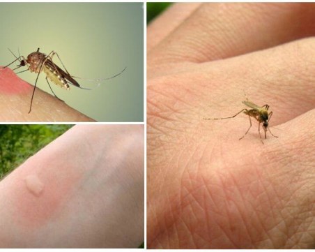 5 причини да сте магнит за комарите