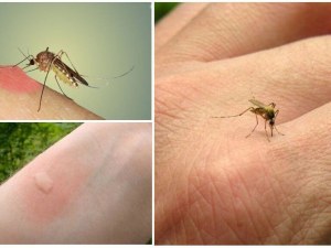 5 причини да сте магнит за комарите