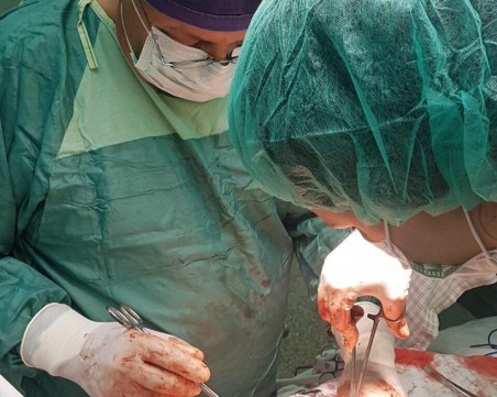 Пловдивски гинеколози извадиха огромна киста от корема на млада жена