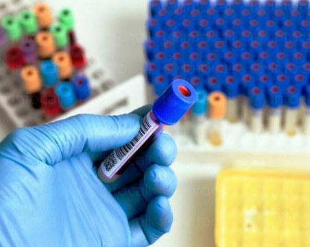 Учени успяха да елиминират вируса ХИВ от ДНК-то на мишки