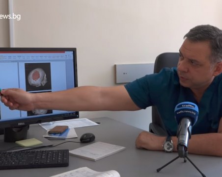 Импланти, направени на 3D принтер, спасяват хора с тежки черепни травми