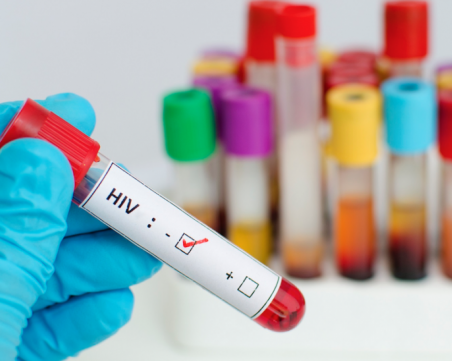 Смъртните случаи от ХИВ намаляват