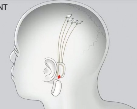 Илон Мъск иска да свърже мозъка с изкуствен интелект чрез имплант