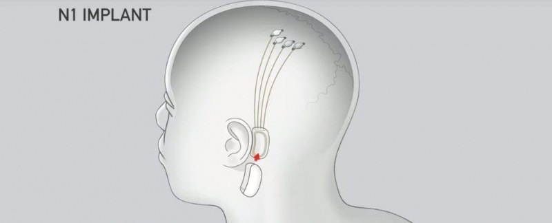 Илон Мъск иска да свърже мозъка с изкуствен интелект чрез имплант