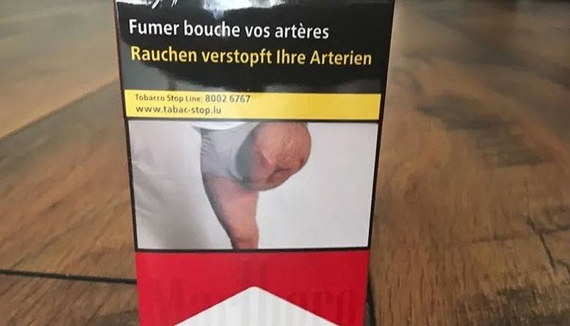 Мъж с ампутиран крак откри снимката си върху пакет цигари