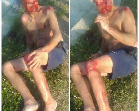 Очевидец: Кола блъсна мъж край Слънчев бряг и избяга СНИМКИ 18+