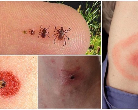 Как да разпознаете ухапванията от различни насекоми