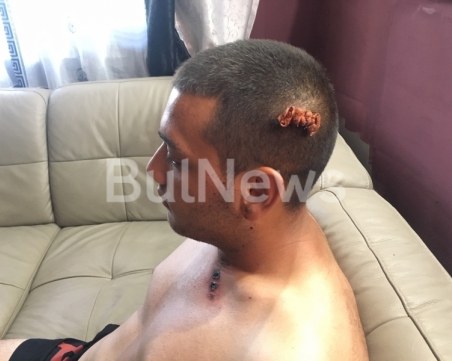 Мъж стреля по 21-годишно момче в парк във Враца