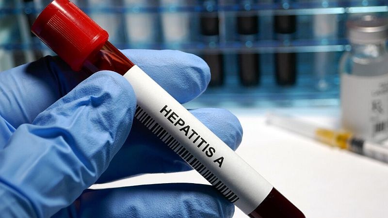 Взрив на варицела и хепатит А в София, 13 области в страната засегнати от морбили