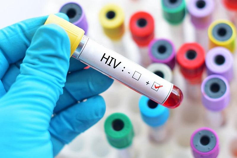 147 нови случая на ХИВ у нас от началото на годината