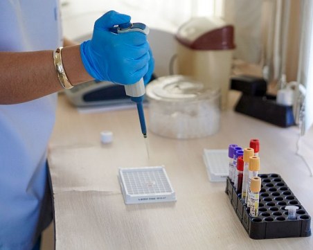 Анализ на кръвта показва дали ще умрем в следващите 5-10 години