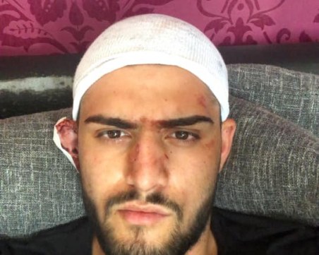 Чужденци нападнаха млад мъж в столицата, ударили го с бутилка в главата