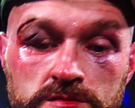 Фюри: Господ ме спаси – не виждах нищо в края на мача