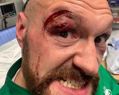 47 шева за Фюри, баща му иска оставки, мачът с Уайлдър може да се отложи