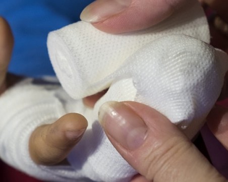 Шкаф отряза пръстите на момиче в детска градина