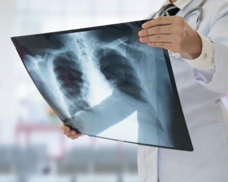 Първа белодробна трансплантация в България