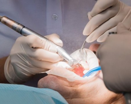 4 см зъб удари рекорд на Гинес