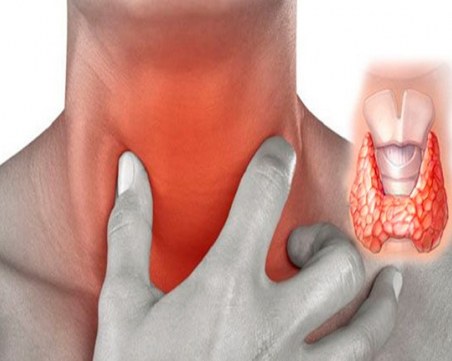 8 неща в дома ни, които убиват щитовидната жлеза и сигурно ни разболяват