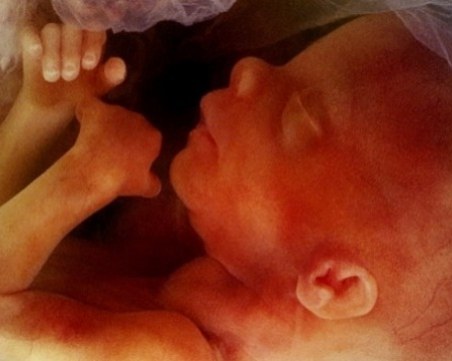 Араби вземат стволови клетки на български бебета?