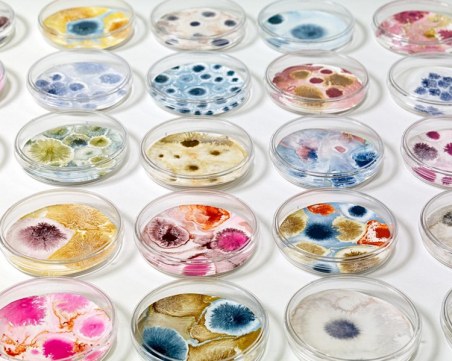 Студенти по медицина от Пловдив превърнаха бактерии и гъбички в изкуство