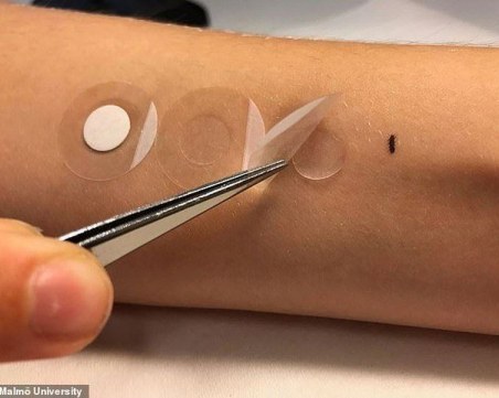 Учени разработват пластир за диагностика на кожния рак