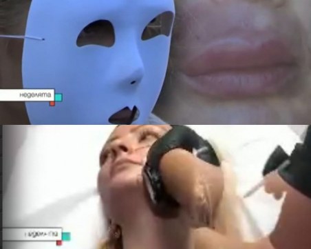 Жертви на козметици, слагащи филъри и ботокс, проговориха в разследване на Тина Ивайлова