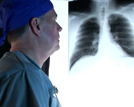 Смъртоносният рак при мъжете най-често е на белия дроб