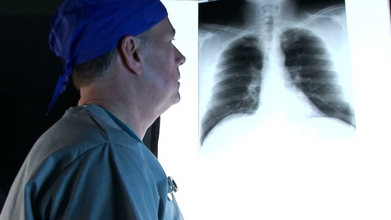 Смъртоносният рак при мъжете най-често е на белия дроб