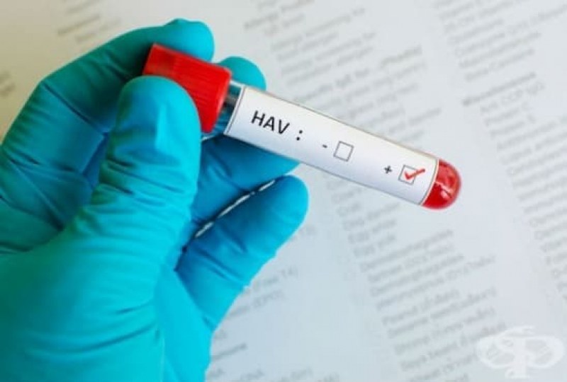 Първокласници в принудителна ваканция заради хепатит А