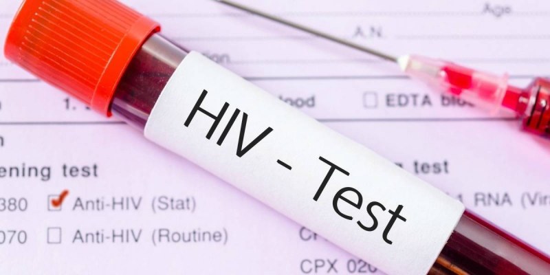 НПО: Пациентите с ХИВ имат ограничен достъп до медицинска помощ