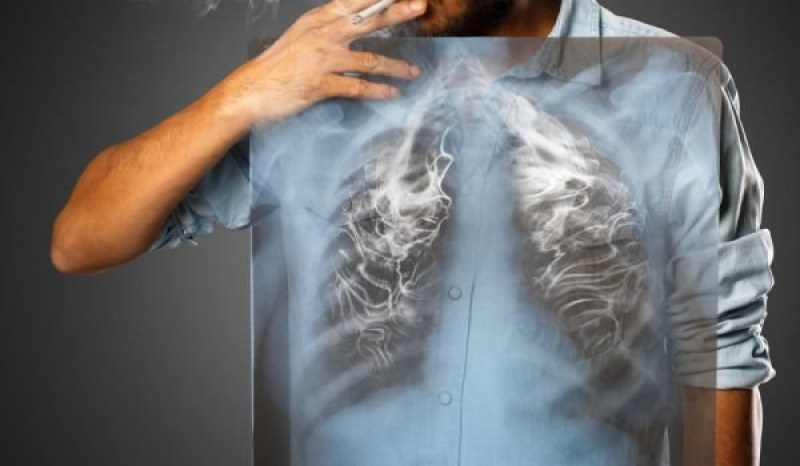 5 знака, че белите ви дробове се нуждаят от помощ